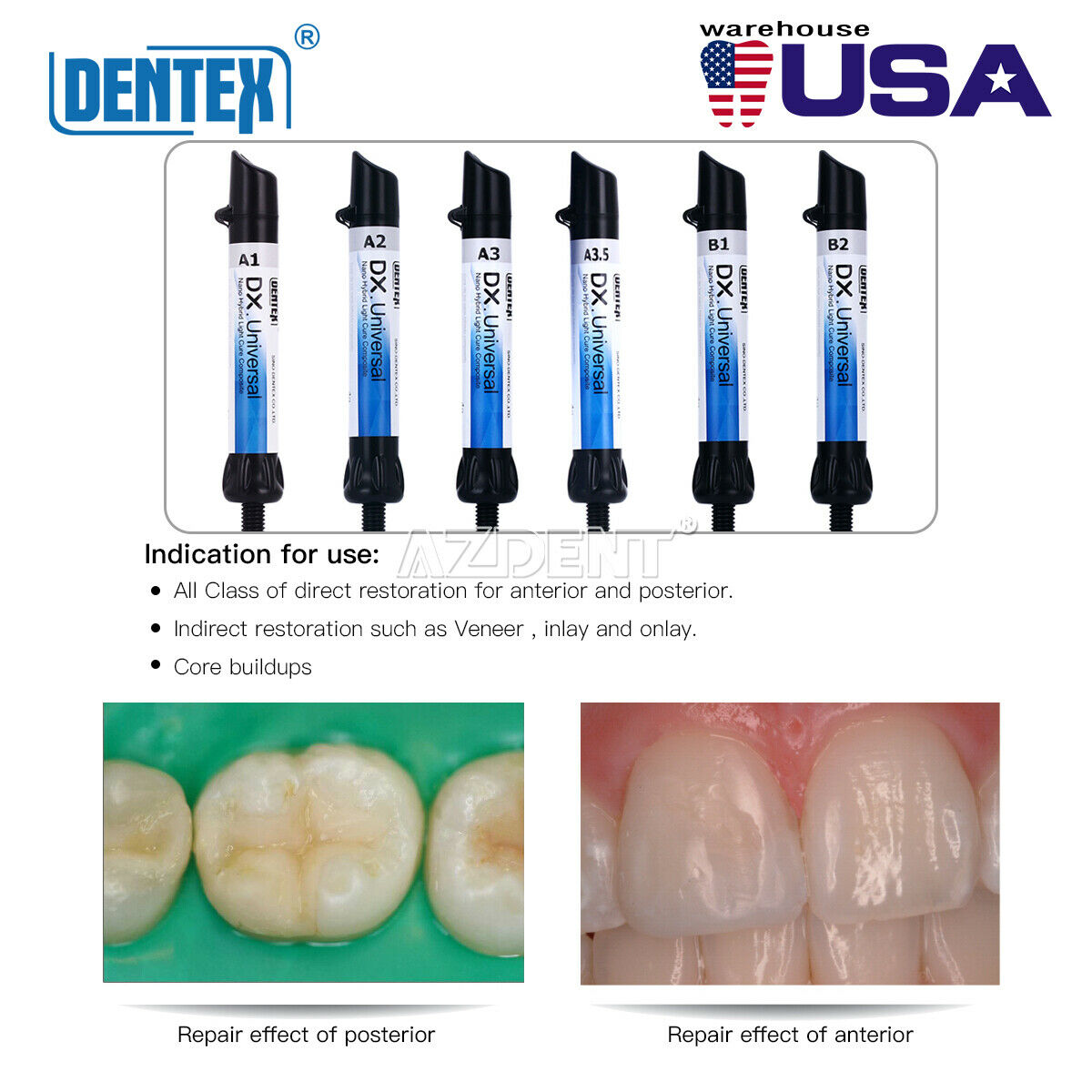 Usa Dentex Dental Universal Composite Resin Light Cure A1 A2 A3 A3.5 B1 B2 Shade